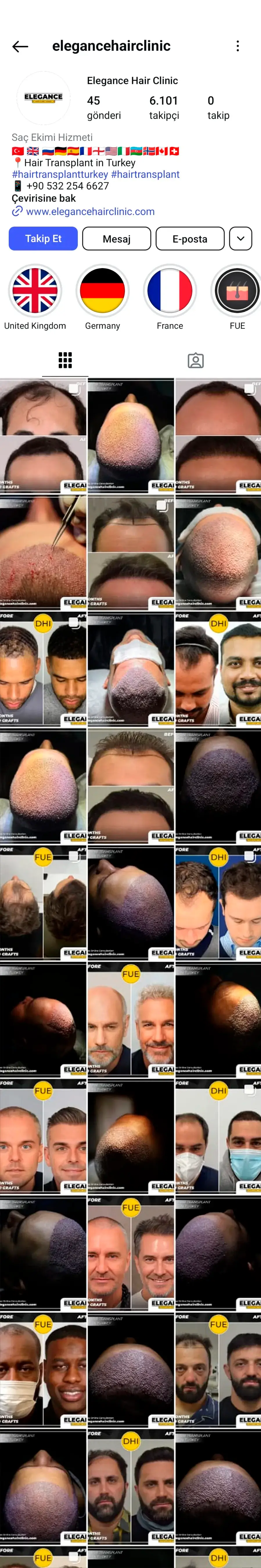 Elegance Hair Clinic