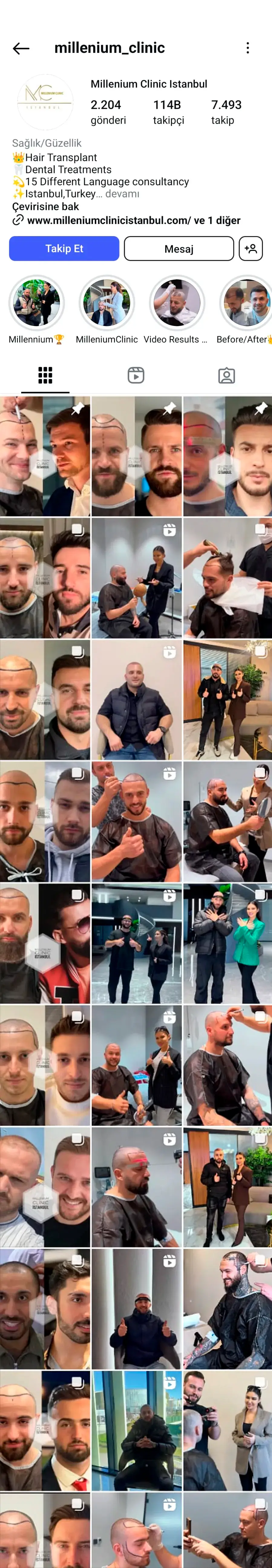 Millenium Hair Clinic